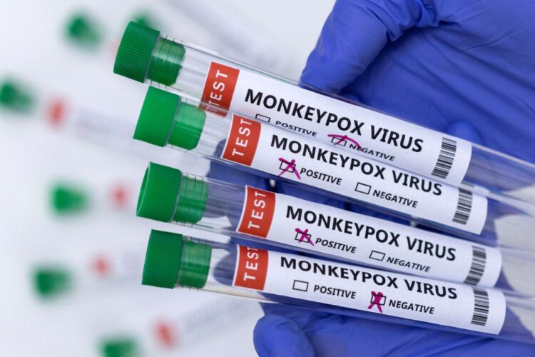 Test para identificar el virus de la viruela del mono. Foto: Archivo