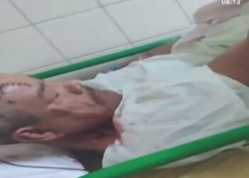 El hombre atacado por dos lagartos en el río Piraí se recupera en un hospital.