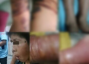 Tres niños fueron torturados por su madre y padrastro. La Policía los rescató.