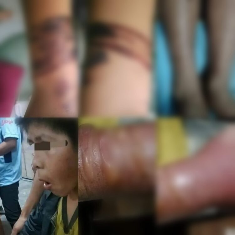 Tres niños fueron torturados por su madre y padrastro. La Policía los rescató.