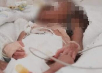 La bebé de tres meses de nacida es atendida en una sala de terapia intensiva.