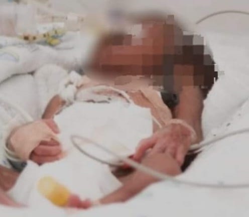 La bebé de tres meses de nacida es atendida en una sala de terapia intensiva.