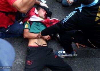 El reportero gráfico Pablo Grillo, fue herido en la cabeza por un proyectil de gas lacrimógeno