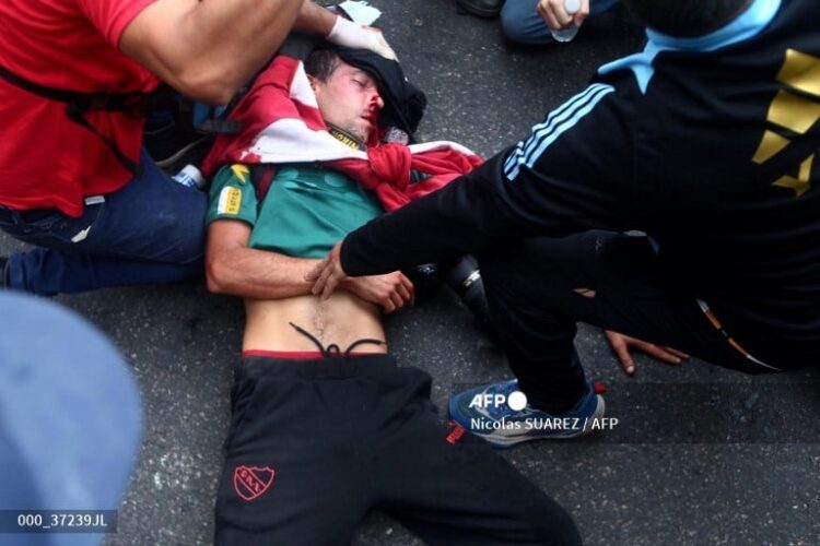 El reportero gráfico Pablo Grillo, fue herido en la cabeza por un proyectil de gas lacrimógeno