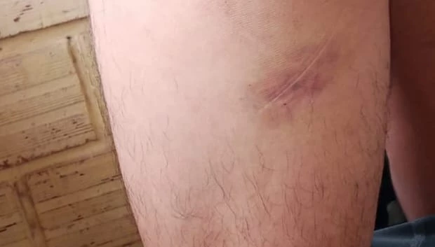Las víctimas tenían marcas de la golpiza en sus cuerpos