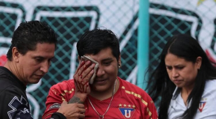 Hincha de Liga Deportiva Universitaria de Quito pierde un ojo por acción de policías antidisturbios
