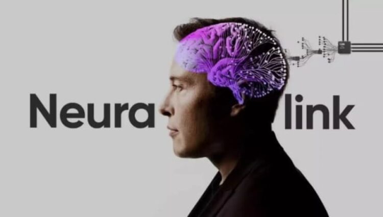 Chip cerebral promete cambios positivos en la calidad de vida de pacientes