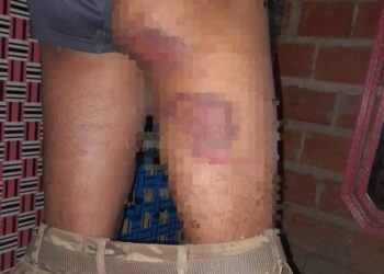 Las huellas que dejaron los golpes del sargento
