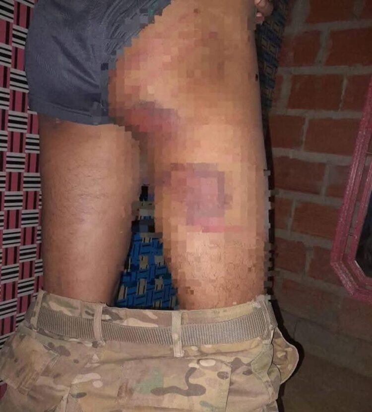 Las huellas que dejaron los golpes del sargento