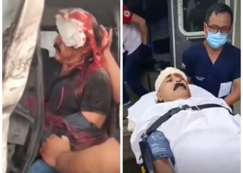 El cantautor Yalo Cuéllar sufrió un accidente de tránsito en la carretera Santa Cruz - Camiri.