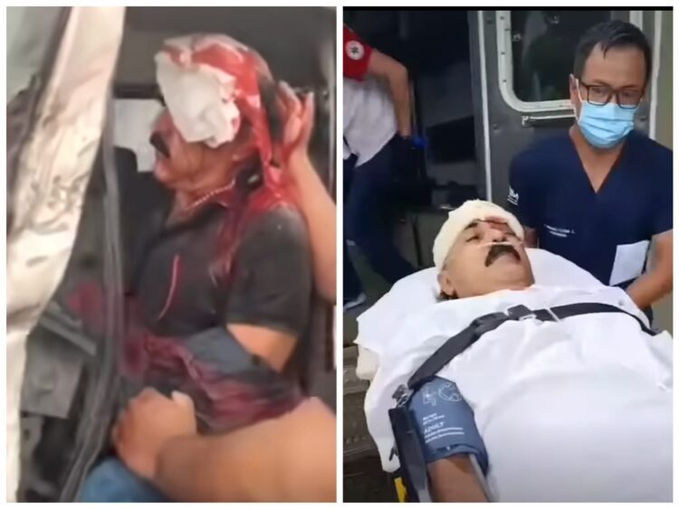 El cantautor Yalo Cuéllar sufrió un accidente de tránsito en la carretera Santa Cruz - Camiri.