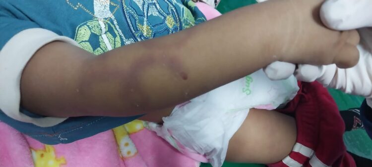 Una bebé de un año de edad murió golpeada y violada.