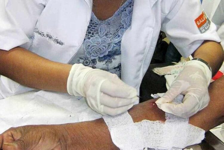 ¿Se registró casos de lepra en Bolivia? Salud brindó el informe de la última década