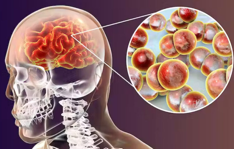 Tarija en alerta tras confirmarse dos casos de meningitis