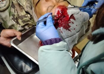 Contrabandistas y comunarios atacan con dinamita y piedras a militares en controles