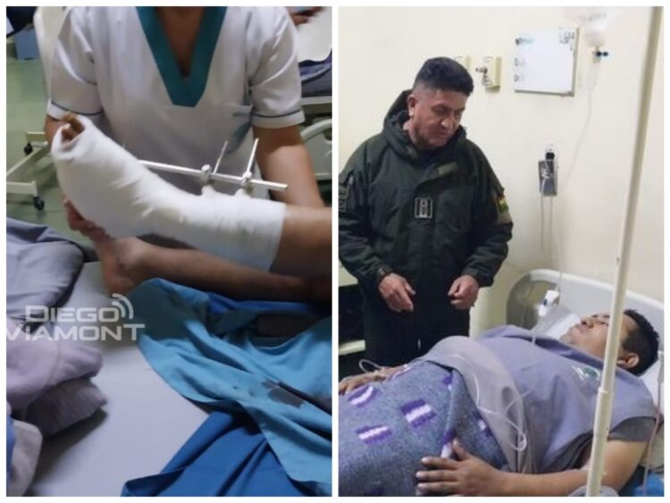 El policía herido por la explosión de una dinamita se recupera en un hospital.