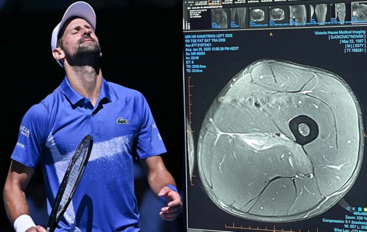 Djokovic publica una resonancia de su muslo e ironiza sobre ‘los expertos’ en lesiones