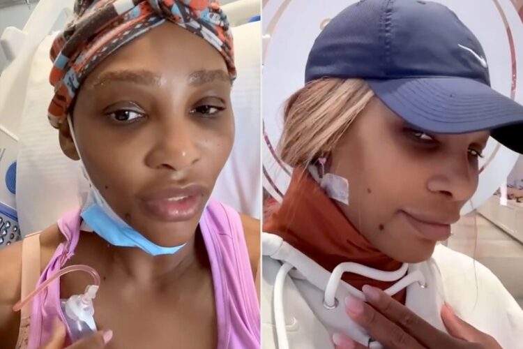 Serena Williams revela que le extirparon quiste del tamaño de un pomelo