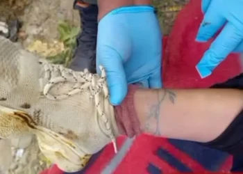 Los miembros inferiores de una mujer fueron hallados dentro de una bolsa. FOTO: RRSS