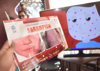 La Dirección Municipal de Salud realiza el bloqueo epidemiológico por sarampión. FOTO: GAMLP