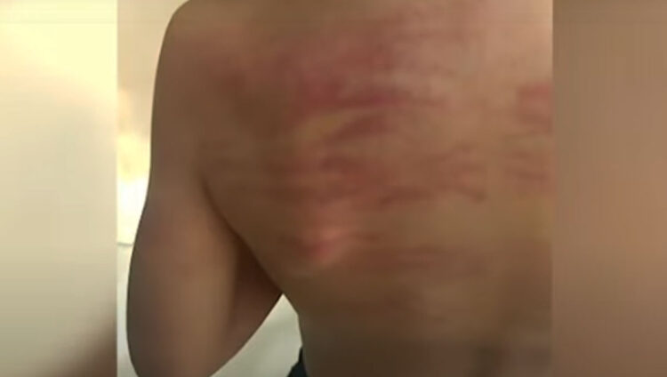Padre que flageló a su hijo de cuatro años es enviado a la cárcel por 150 días