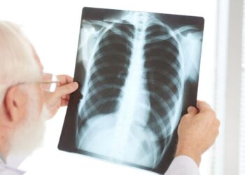 Quinta muerte en Argentina por una bacteria que causa neumonía