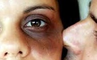 En Bolivia se reportan a diario 129 casos de violencia intrafamiliar