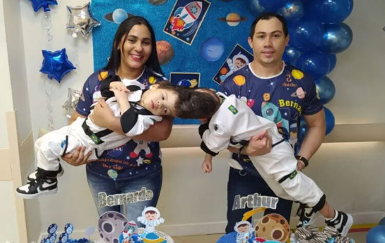 Siameses brasileños unidos por el cráneo separados con ayuda de realidad virtual
