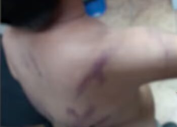 Solo quería jugar: niño es flagelado por su padre con un cable y cinturón, por meter ruido