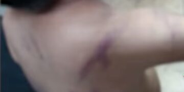 Solo quería jugar: niño es flagelado por su padre con un cable y cinturón, por meter ruido