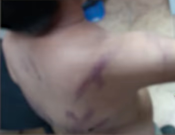 Solo quería jugar: niño es flagelado por su padre con un cable y cinturón, por meter ruido