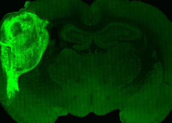 Implantan células humanas en el cerebro de una rata. Foto: AFP.