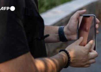 India informa la muerte de un hombre contagiado con viruela del mono