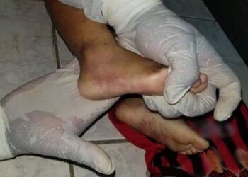 Víctima de maltratos y desnutrición, un niño de ocho años fue asesinado en La Paz