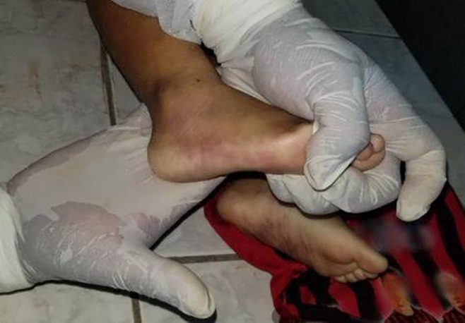 Víctima de maltratos y desnutrición, un niño de ocho años fue asesinado en La Paz
