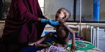 La ‘tragedia’ del hambre obliga a ingresar a un niño por minuto en Somalia