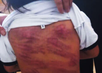 Pedirán cárcel para hombre que flageló a un niño con síndrome de Down en Santa Cruz