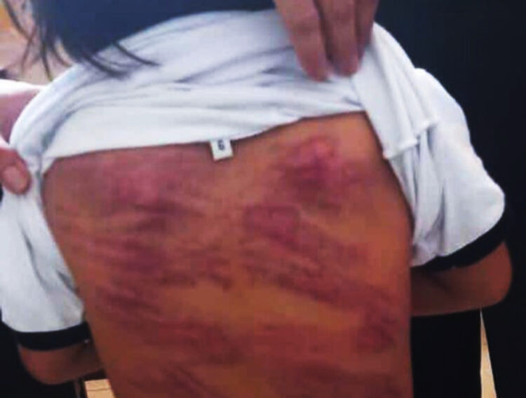 Pedirán cárcel para hombre que flageló a un niño con síndrome de Down en Santa Cruz