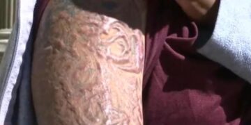El brazo izquierdo donde se hizo el tatuaje
