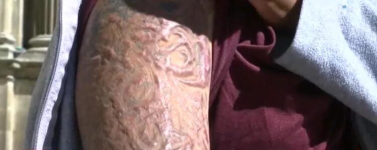 El brazo izquierdo donde se hizo el tatuaje