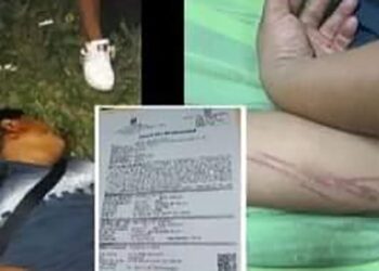 Aprehenden a implicado en golpiza que dejó moribundo a un vecino