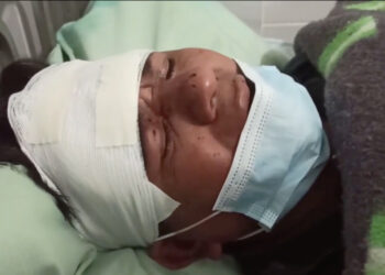 Ríos: Periodista agredido en La Guardia estaba en medio de policías, cívicos y unionistas