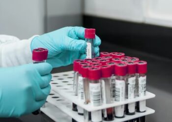 Japón autoriza una prueba sanguínea para detectar el Alzheimer.