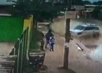 Niño atropellado en el Plan 3.000 tiene un pulmón perforado y la madre pide ayuda