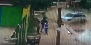 Niño atropellado en el Plan 3.000 tiene un pulmón perforado y la madre pide ayuda