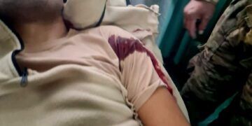 Uno de los heridos durante los enfrentamientos entre "chuteros" y militares