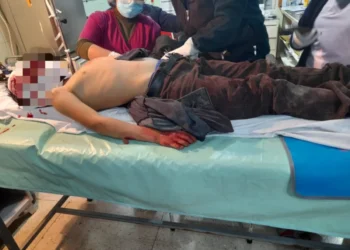Hombre que atacó con un cuchillo y un martillo a su hijo es detenido preventivamente