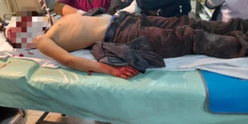 Hombre que atacó con un cuchillo y un martillo a su hijo es detenido preventivamente