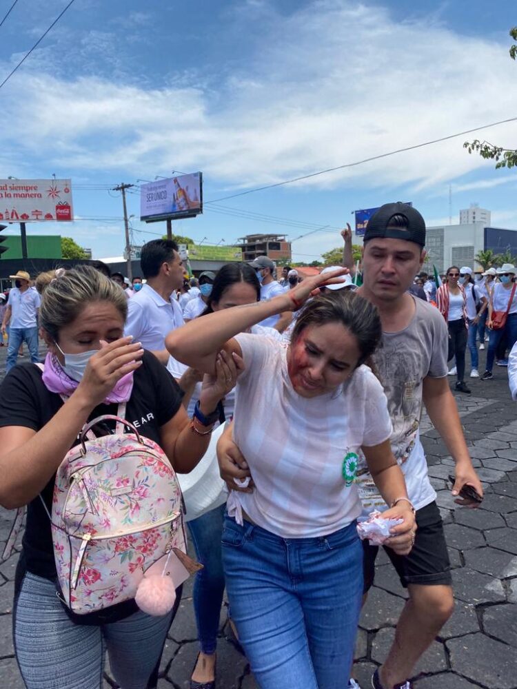 Policía reprime marcha liderada por funcionarios de la Gobernación cruceña