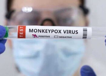 Test para detectar la viruela del mono. Foto: AFP